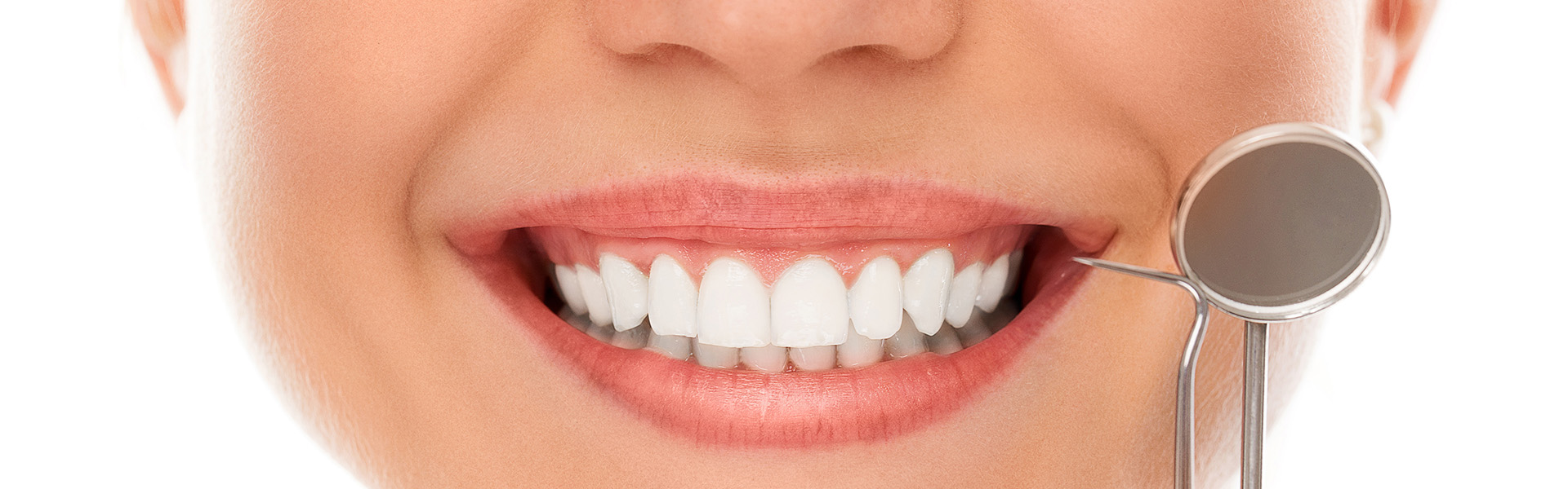 Bleaching im Zahnzentrum Hiltrup